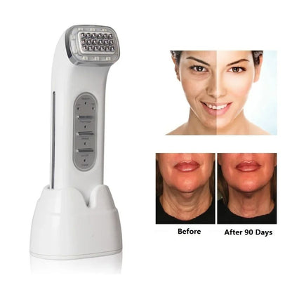Radiofrequency Skin Tightening Device For Face And Body Anti Wrinkle Care 1