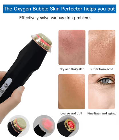 NEWGAGA Portable CO2 Oxygen Bubble Pen Rechargeable Facial Cleansing Device For Anti Aging Skin Car 1