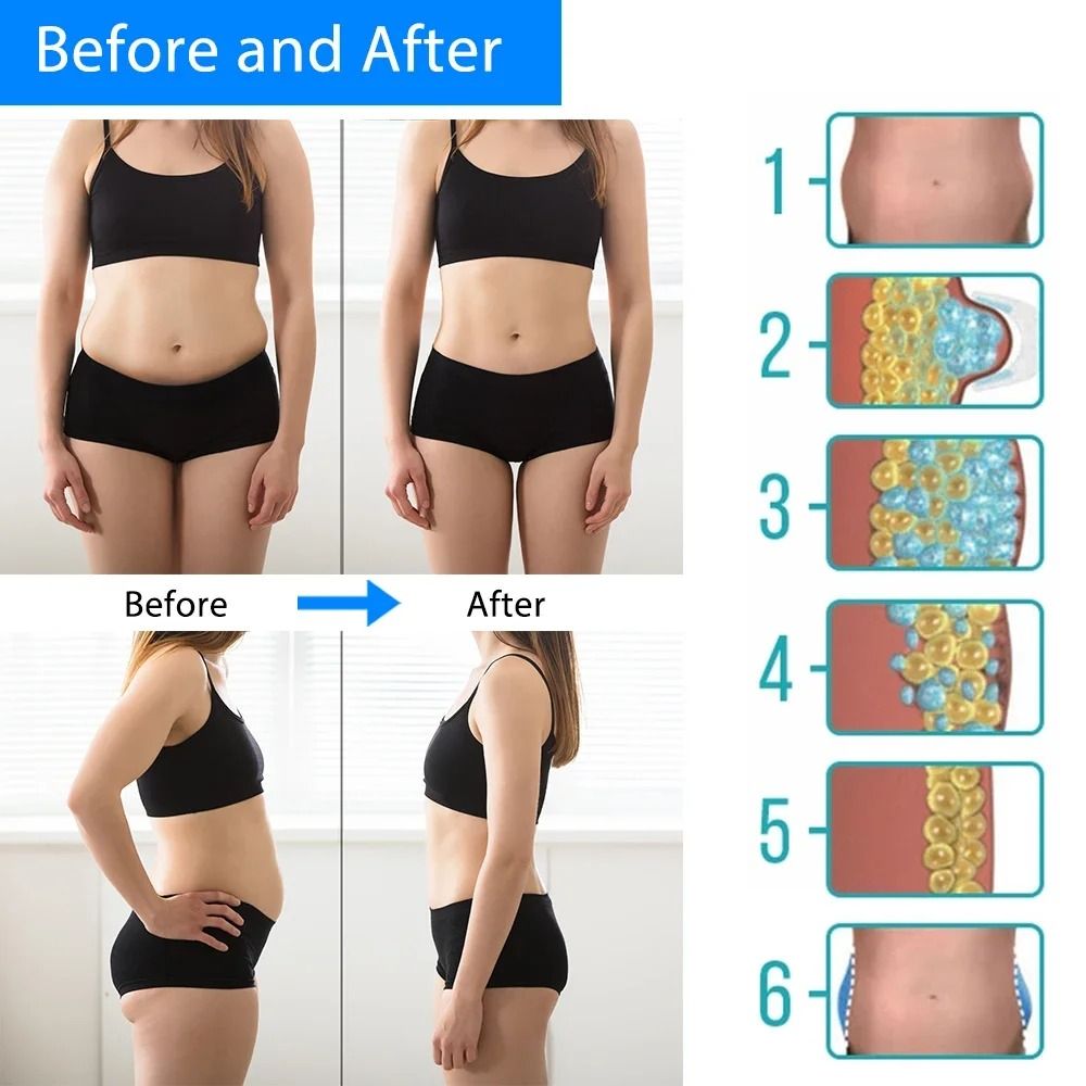 Cryotherapy Fat Freezing Machine Body Slimming And Cellulite Reduction Device 4