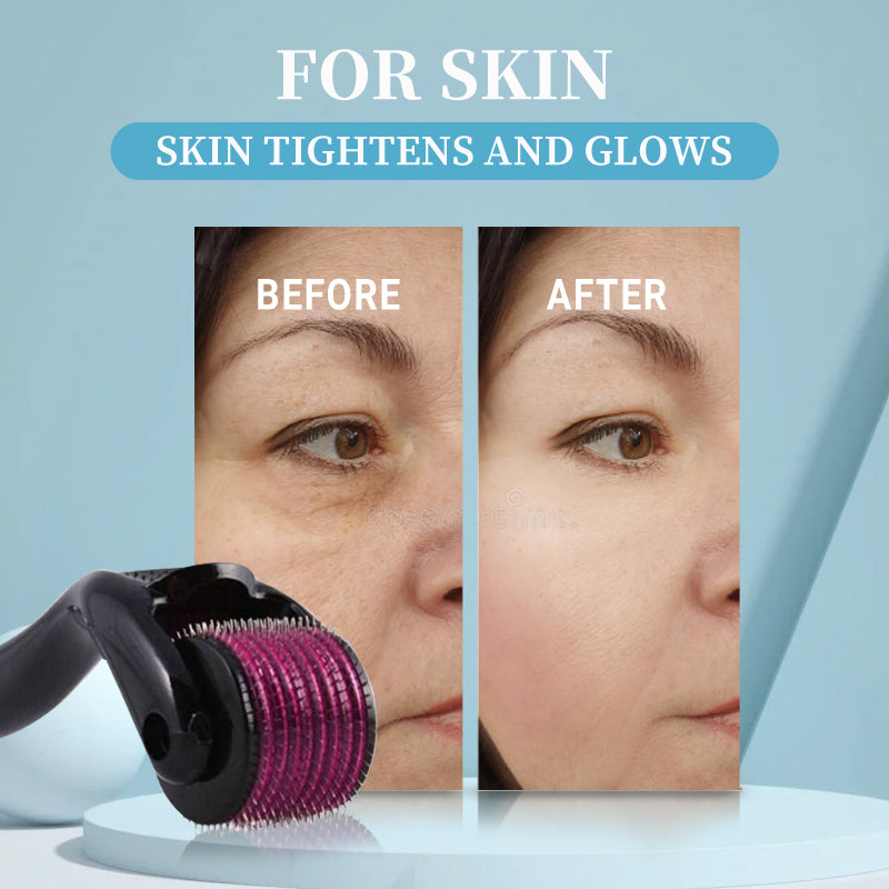Professional Titanium Micro Needling Roller Derma Roller Dermaroller Hair Regrowth & Beard Growth Therapy