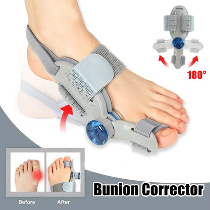 Adjustable Bunion Corrector – Big Toe Straightener and Hallux Valgus Support with Rotating Alignment