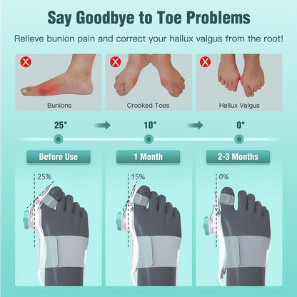 Adjustable Bunion Corrector  Big Toe Straightener And Hallux Valgus Support With Rotating Alignment 2