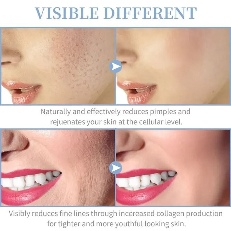 4 In 1 Portable High Frequency Facial Therapy Wand Skin Beauty Machine 5