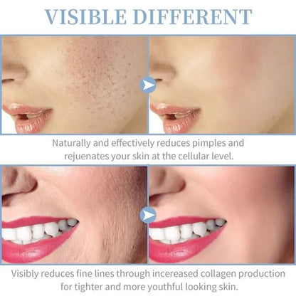 4 In 1 Portable High Frequency Facial Therapy Wand Skin Beauty Machine 5