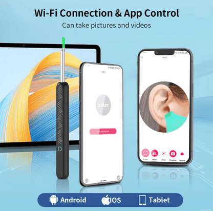 Wireless Ear Cleaner With Camera Rechargeable Otoscope Wax Removal Tool 2