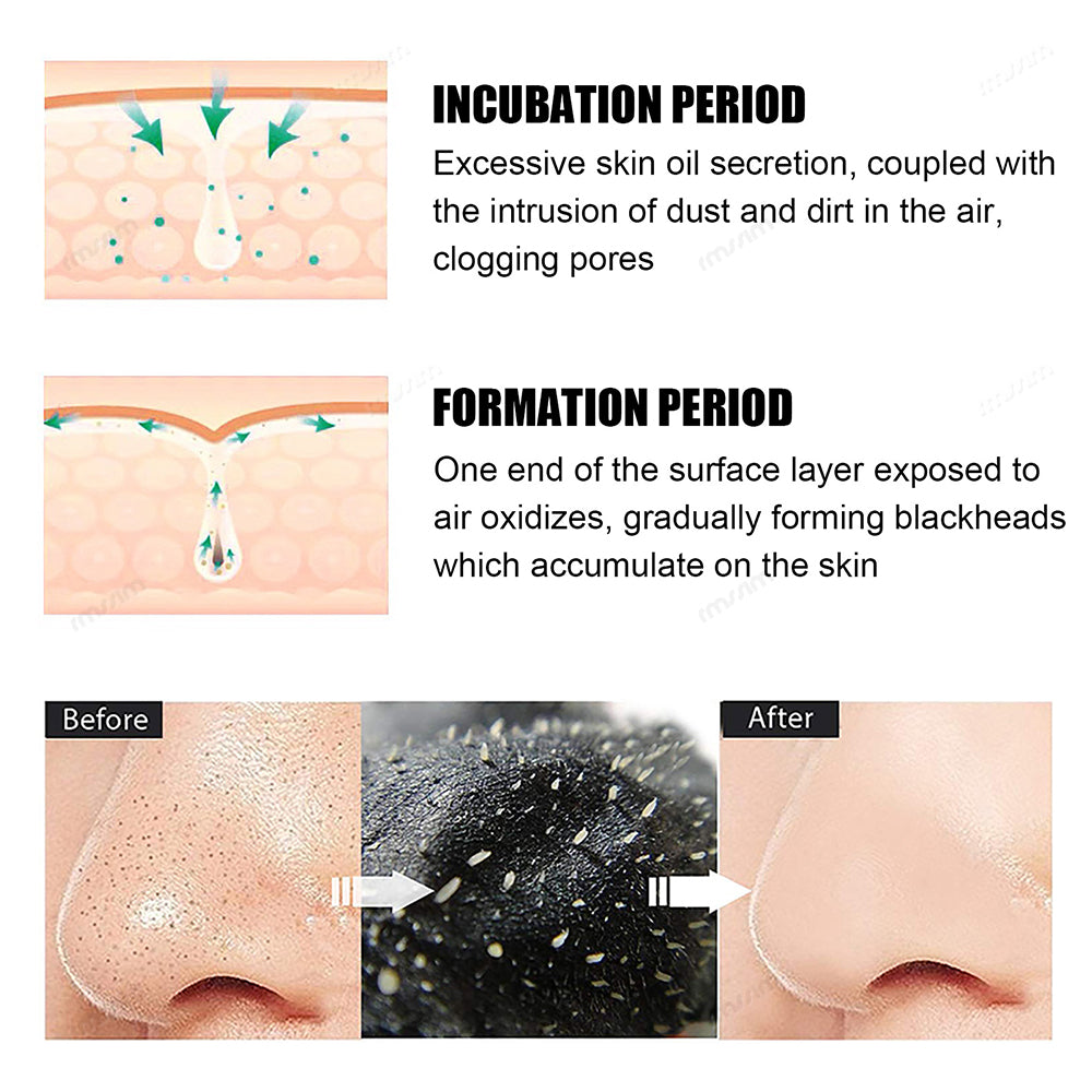Deep Cleansing Black Pig Nose Stick Bamboo Charcoal To Remove Blackheads Remove Acne Clean Pores Ad 2