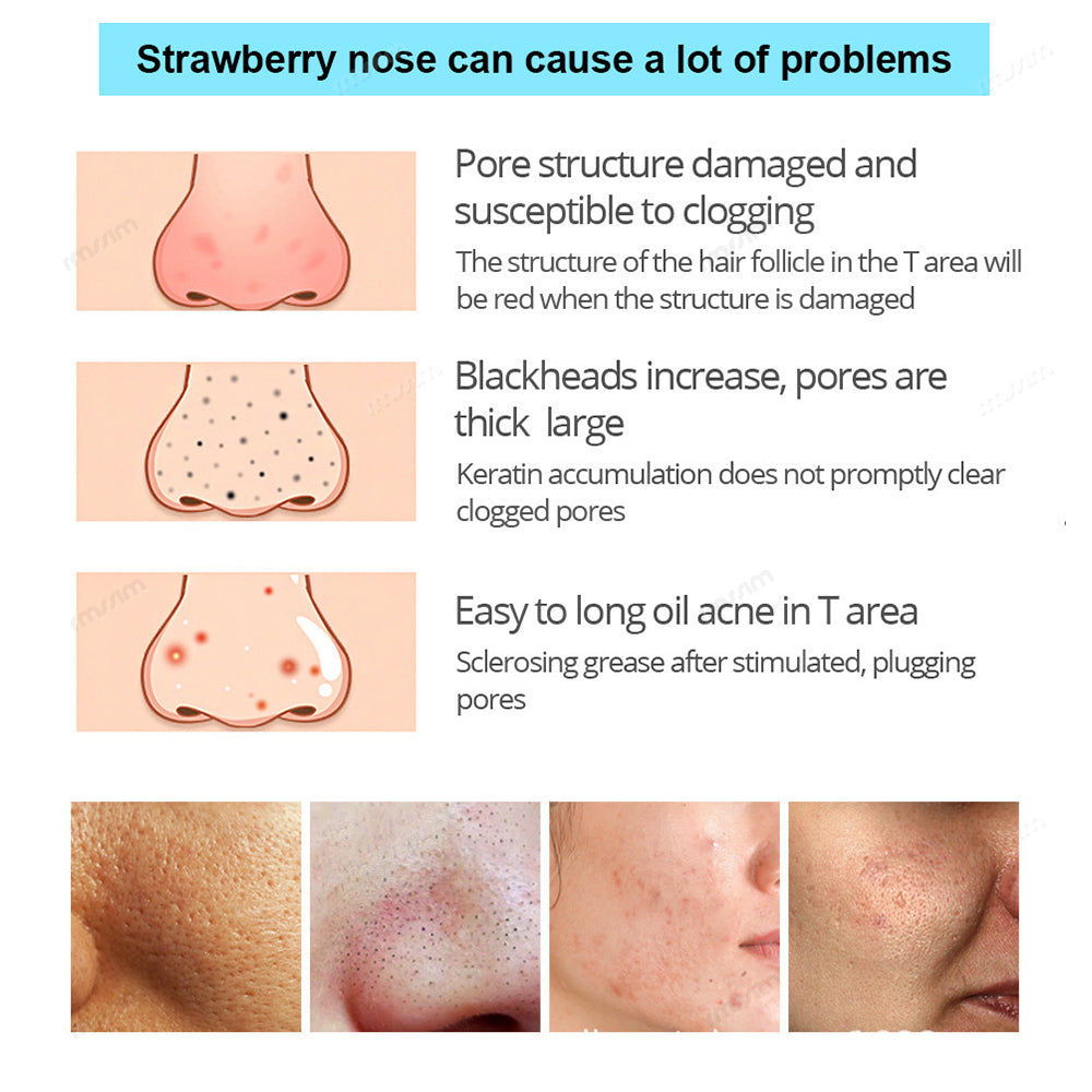 Deep Cleansing Black Pig Nose Stick Bamboo Charcoal To Remove Blackheads Remove Acne Clean Pores Ad 4