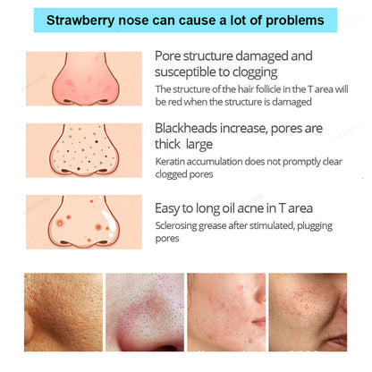 Deep Cleansing Black Pig Nose Stick Bamboo Charcoal To Remove Blackheads Remove Acne Clean Pores Ad 4