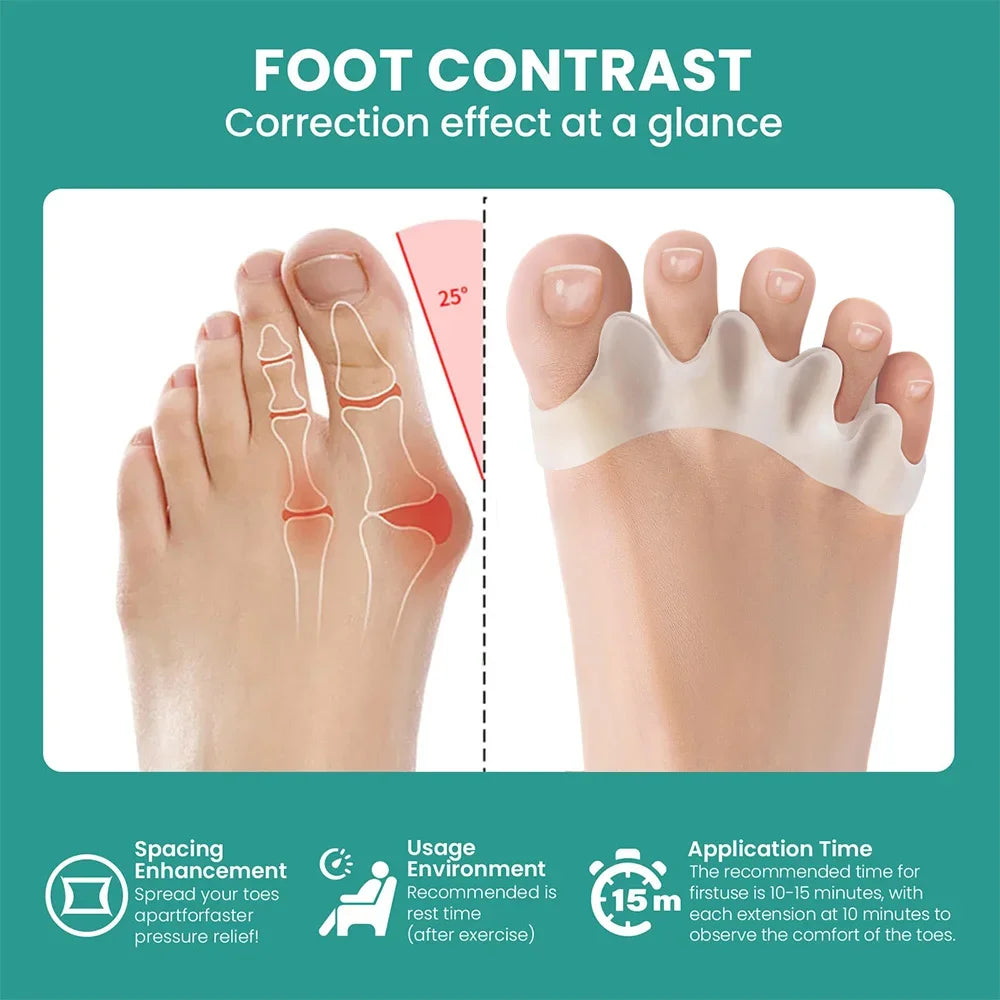 Silicone Toe Separator Bunion Corrector Soft Hammer Toe Straightener  Toe Alignment Foot Care Tool  2
