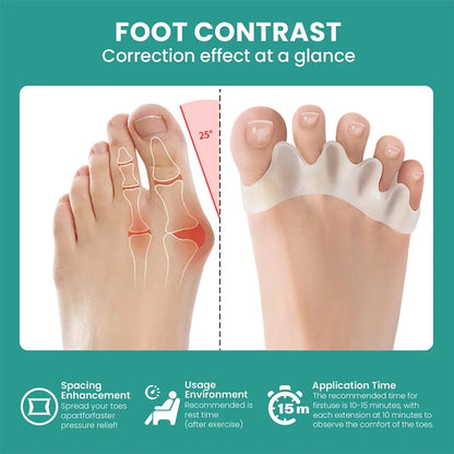 Silicone Toe Separator Bunion Corrector Soft Hammer Toe Straightener  Toe Alignment Foot Care Tool  2