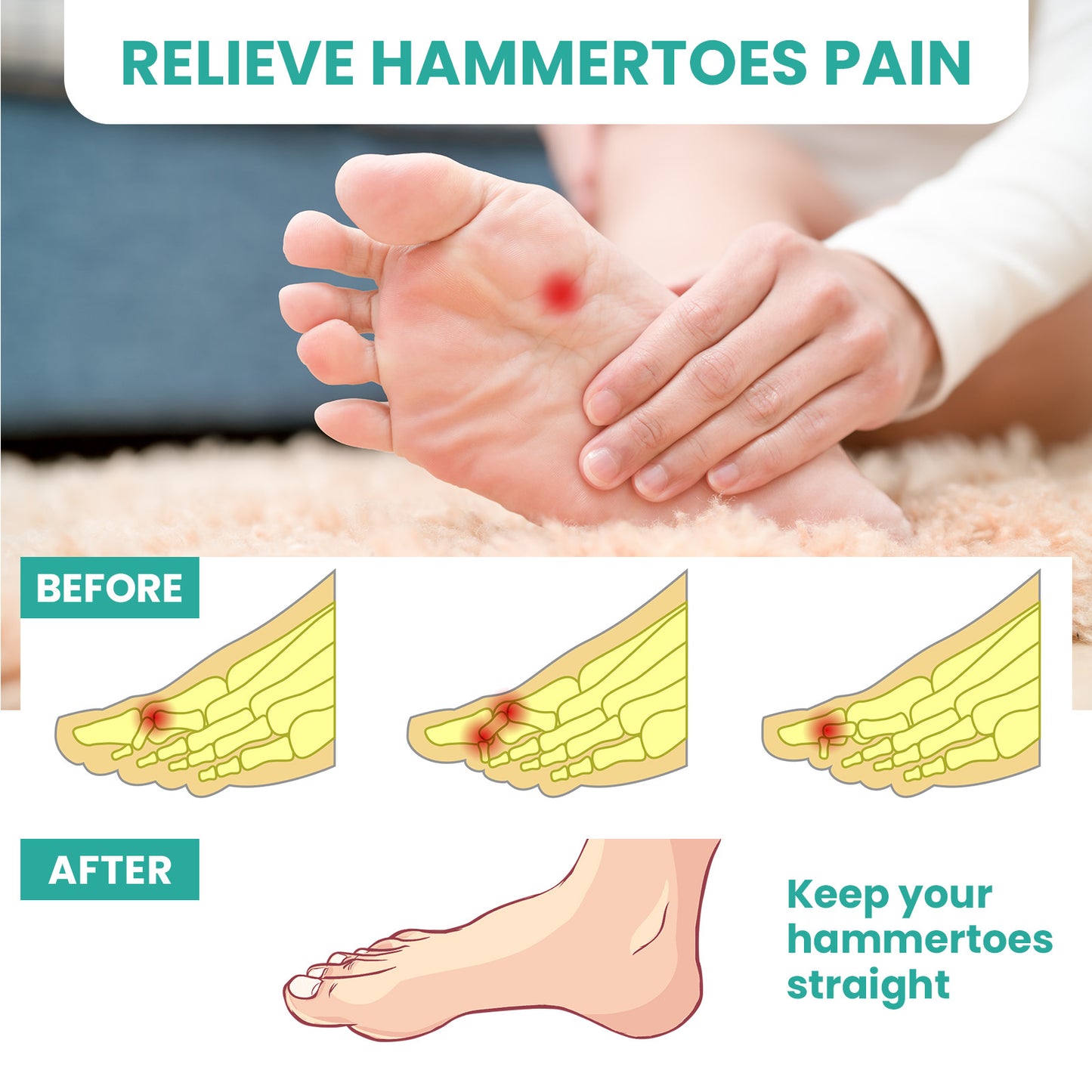 Sumifun Silicone White Toe Separator for Bunion, Hallux Valgus & Overlapping Toes, Foot Adjuster & Straightener Health