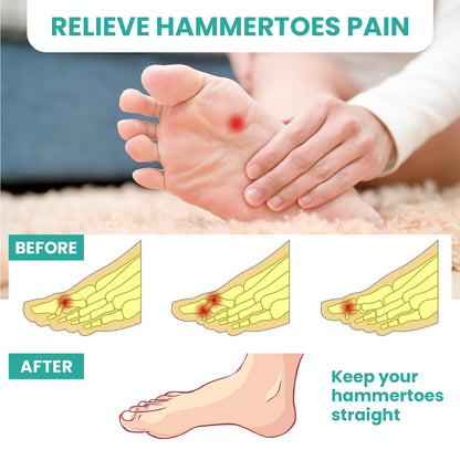 Sumifun Silicone White Toe Separator for Bunion, Hallux Valgus & Overlapping Toes, Foot Adjuster & Straightener Health
