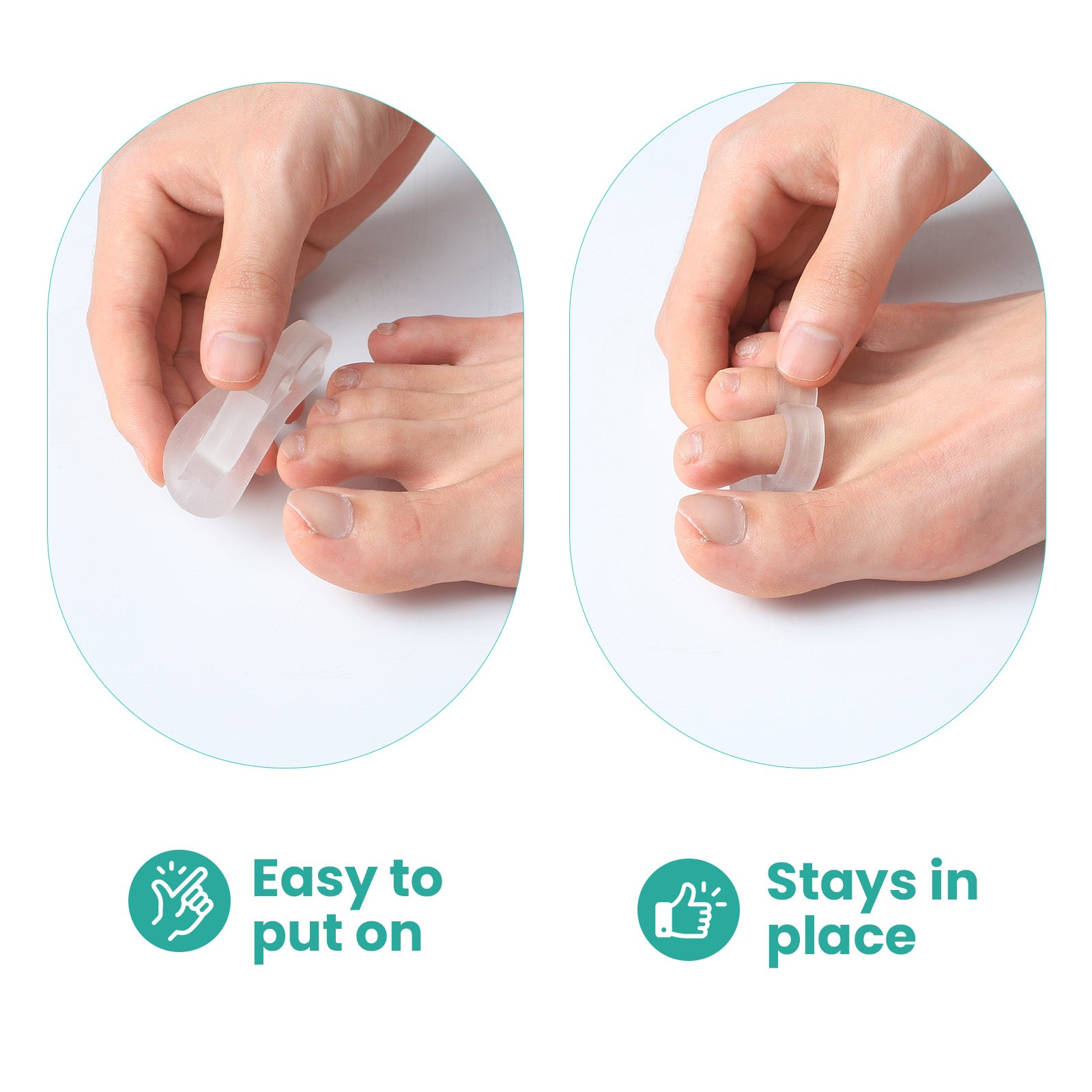 Sumifun Silicone White Toe Separator for Bunion, Hallux Valgus & Overlapping Toes, Foot Adjuster & Straightener Health