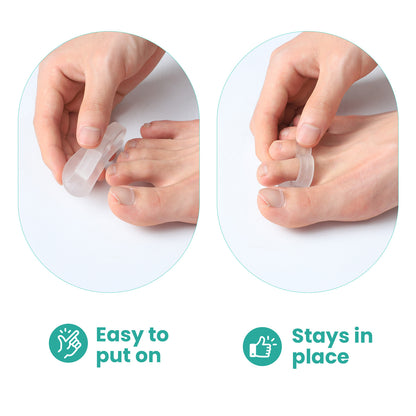 Sumifun Silicone White Toe Separator for Bunion, Hallux Valgus & Overlapping Toes, Foot Adjuster & Straightener Health