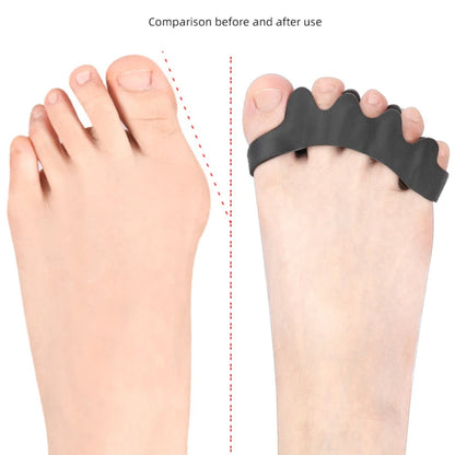 Silicone Toe Separators Thumb Valgus Bunion Adjuster Gel Splitter Hammer Corrector Protector For Fo 3