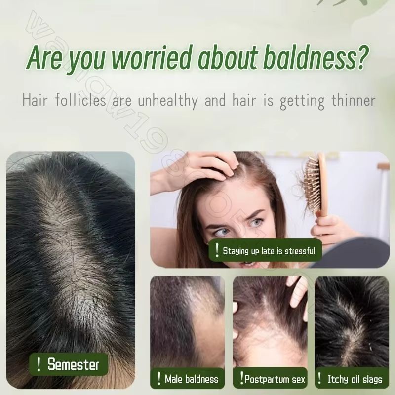 Herbal Hair Growth Soap  Handmade PlantBased Cleanser For Strong Roots  Reduced Hair Loss 2