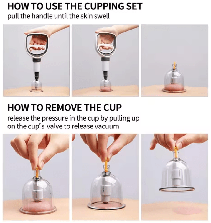 Vacuum Cupping Therapy Set For Massage And Anti Cellulite Care 2