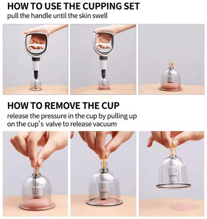Vacuum Cupping Therapy Set For Massage And Anti Cellulite Care 2