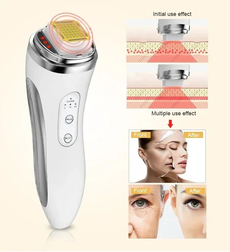 RF Radio Frequency Face Lifting Device Skin Tightening Beauty Massager 3