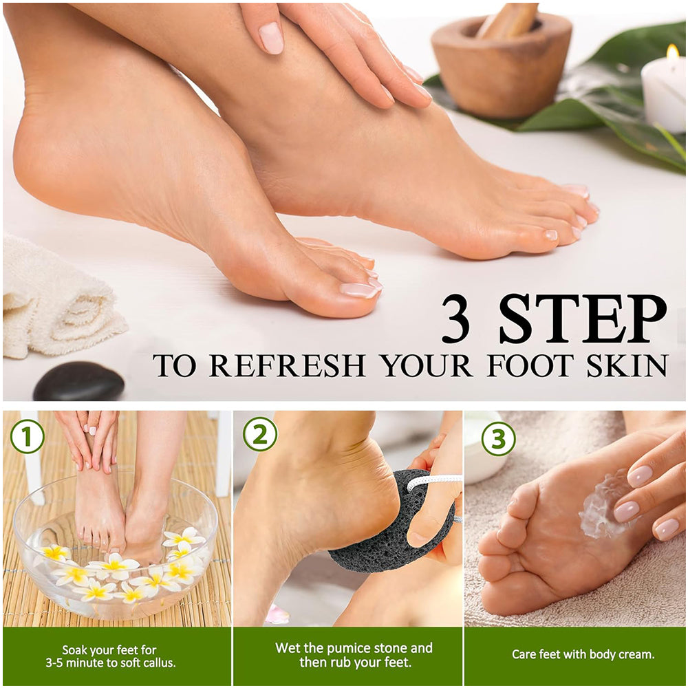 Natural Lava Pumice Stone Callus Remover, Foot, Heel & Hand Scrubber for Hard Skin, Gentle Exfoliation & Callus Care