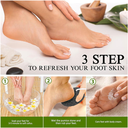 Natural Lava Pumice Stone Callus Remover, Foot, Heel & Hand Scrubber for Hard Skin, Gentle Exfoliation & Callus Care