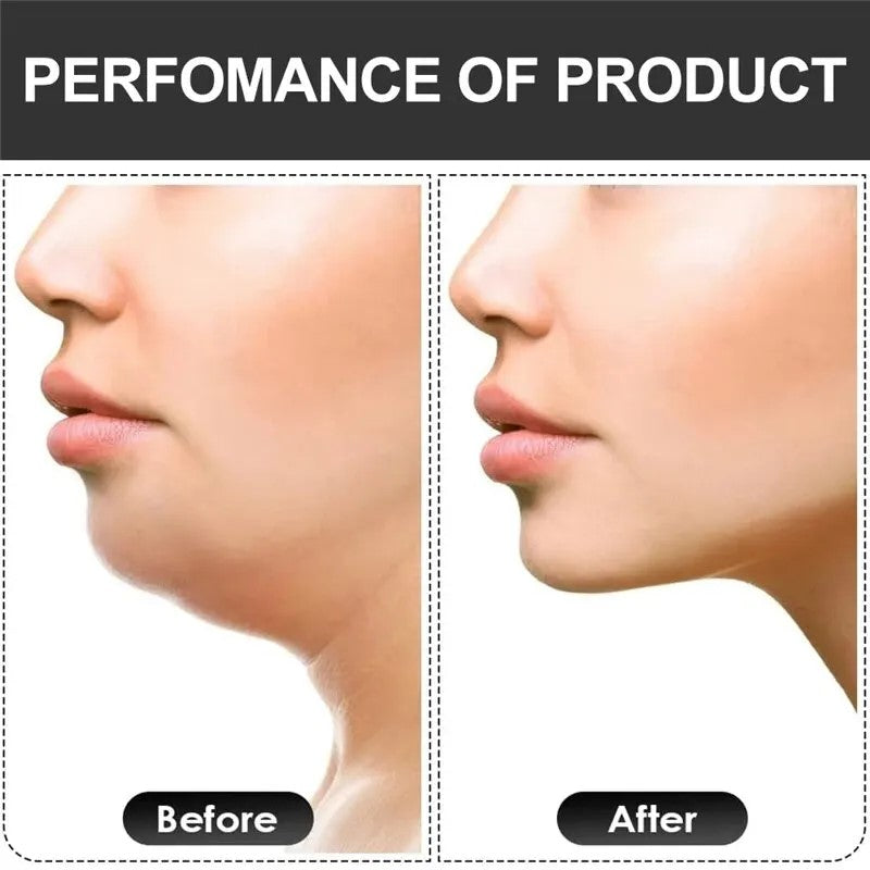 Jaw Exerciser U Shape Muscle Chew Ball for Face Fitness, Bite Breaker Training Equipment New Facial Mouth