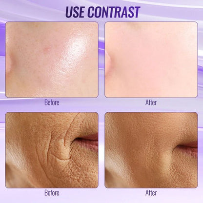 Dual Mode High Frequency Wand For Skin Care And Acne Treatment 4