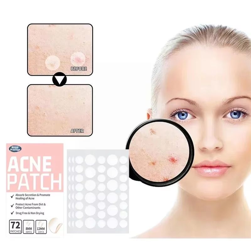 Invisible Hydrocolloid Acne Patches  Waterproof Pimple Removal  Spot Repair Stickers 72180pcs 1