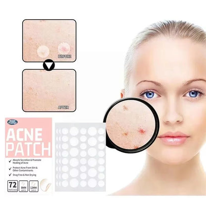 Invisible Hydrocolloid Acne Patches  Waterproof Pimple Removal  Spot Repair Stickers 72180pcs 1