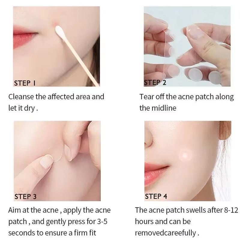 Invisible Hydrocolloid Acne Patches  Waterproof Pimple Removal  Spot Repair Stickers 72180pcs 2