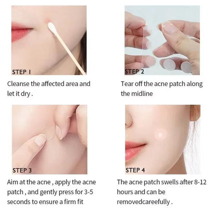 Invisible Hydrocolloid Acne Patches  Waterproof Pimple Removal  Spot Repair Stickers 72180pcs 2