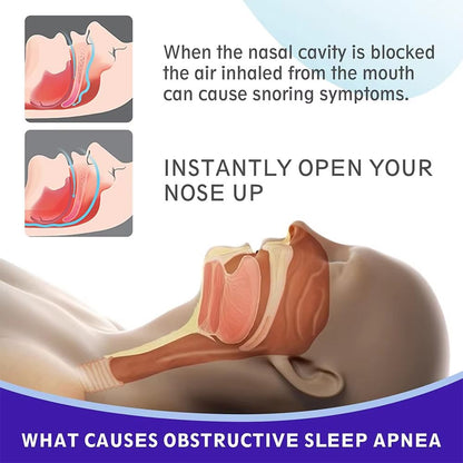 Extra Strength AntiSnoring Nose Strips  Black Nasal Strips For Better Sleep 306090 Pcs 2