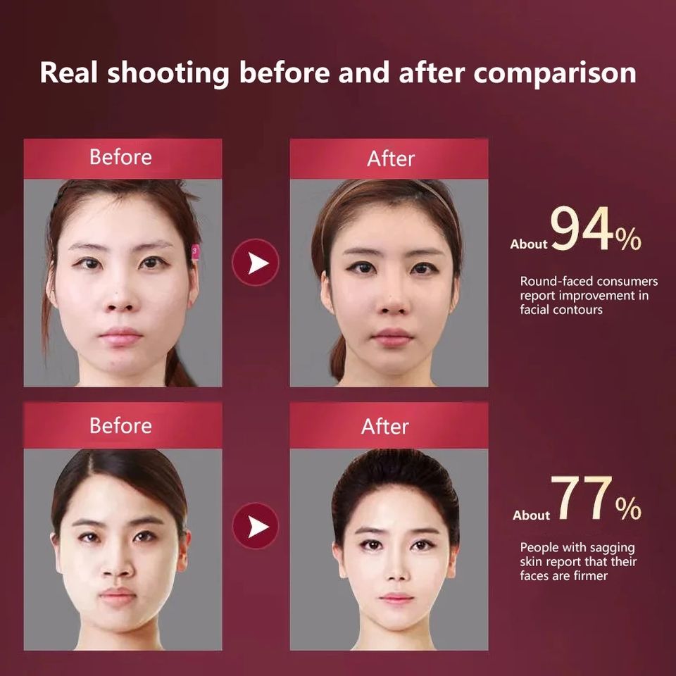 Facial Lifting Device, LED Photon Therapy Slimming Massager, Heated Double Chin V Face Vibration