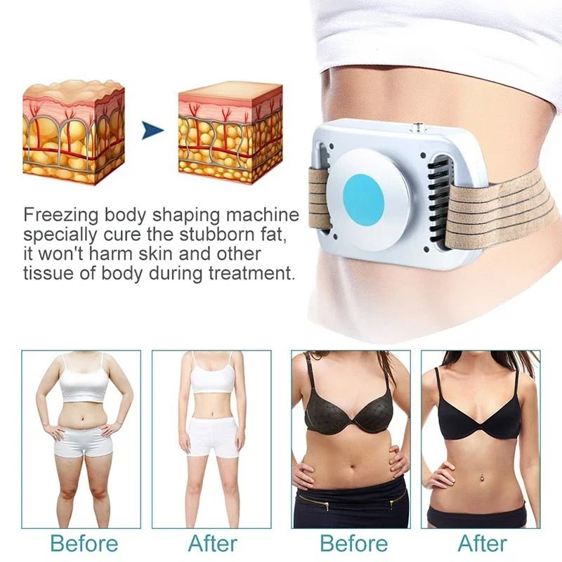 Cryolipolysis Fat Freezing Device For Belly Fat Reduction 1