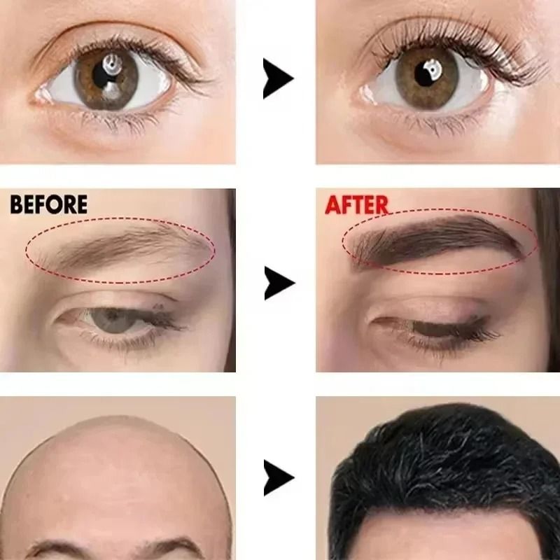 Eyebrow And Eyelash Growth Serum For Fuller And Thicker Hair 1