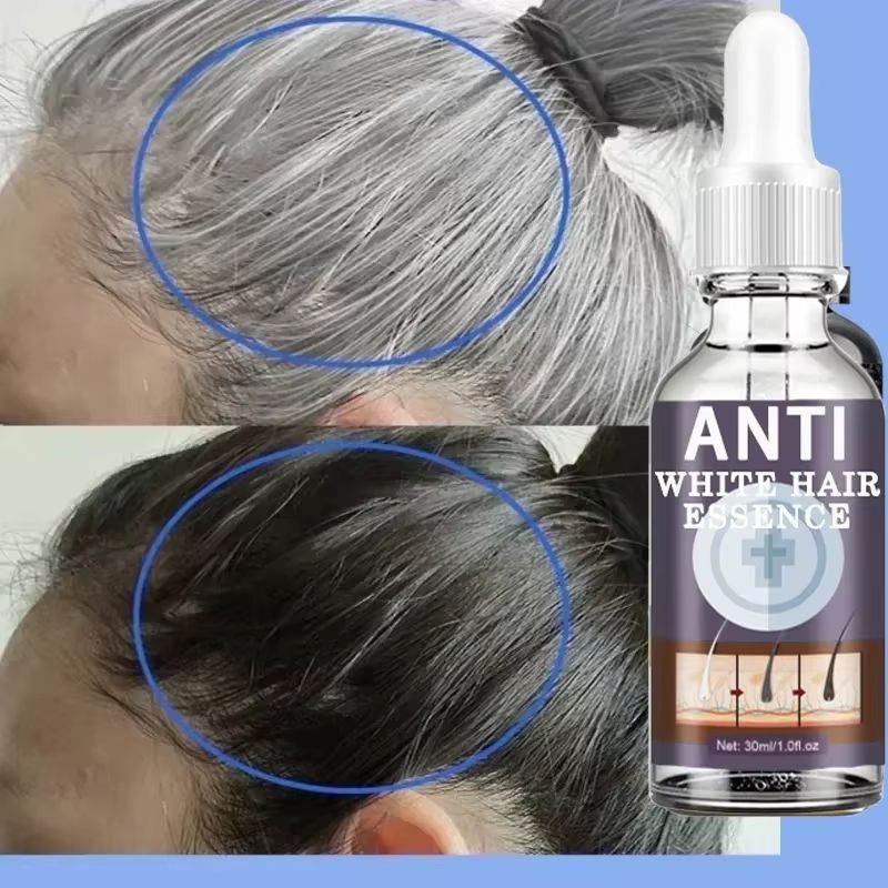 Natural Gray Hair Restoring Serum – White Hair Treatment to Revive Original Color in 7 Days