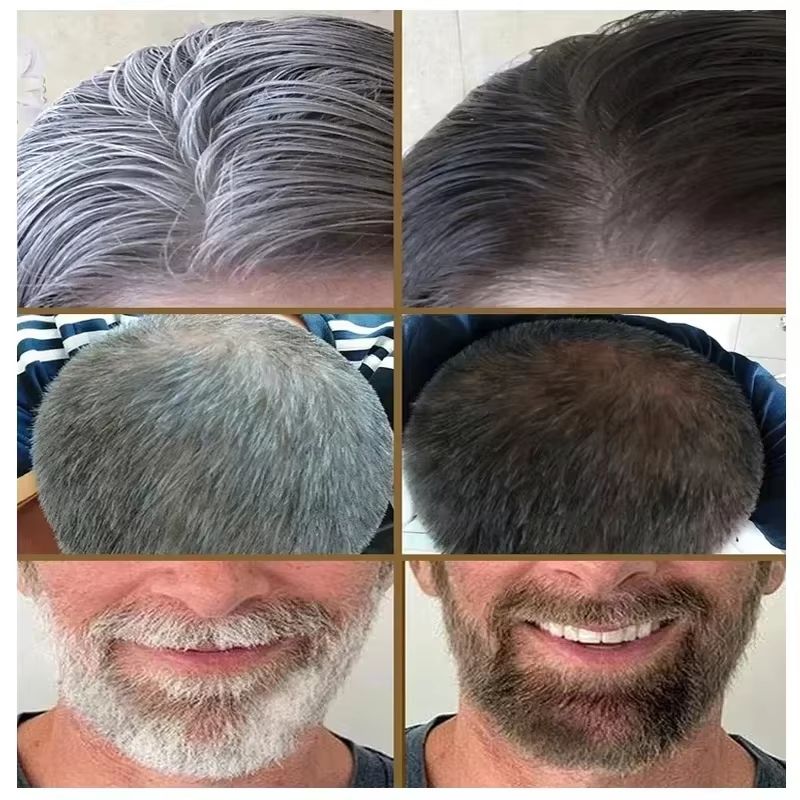 Natural Gray Hair Restoring Serum  White Hair Treatment To Revive Original Color In 7 Days 1