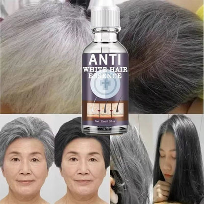 Natural Gray Hair Restoring Serum  White Hair Treatment To Revive Original Color In 7 Days 3