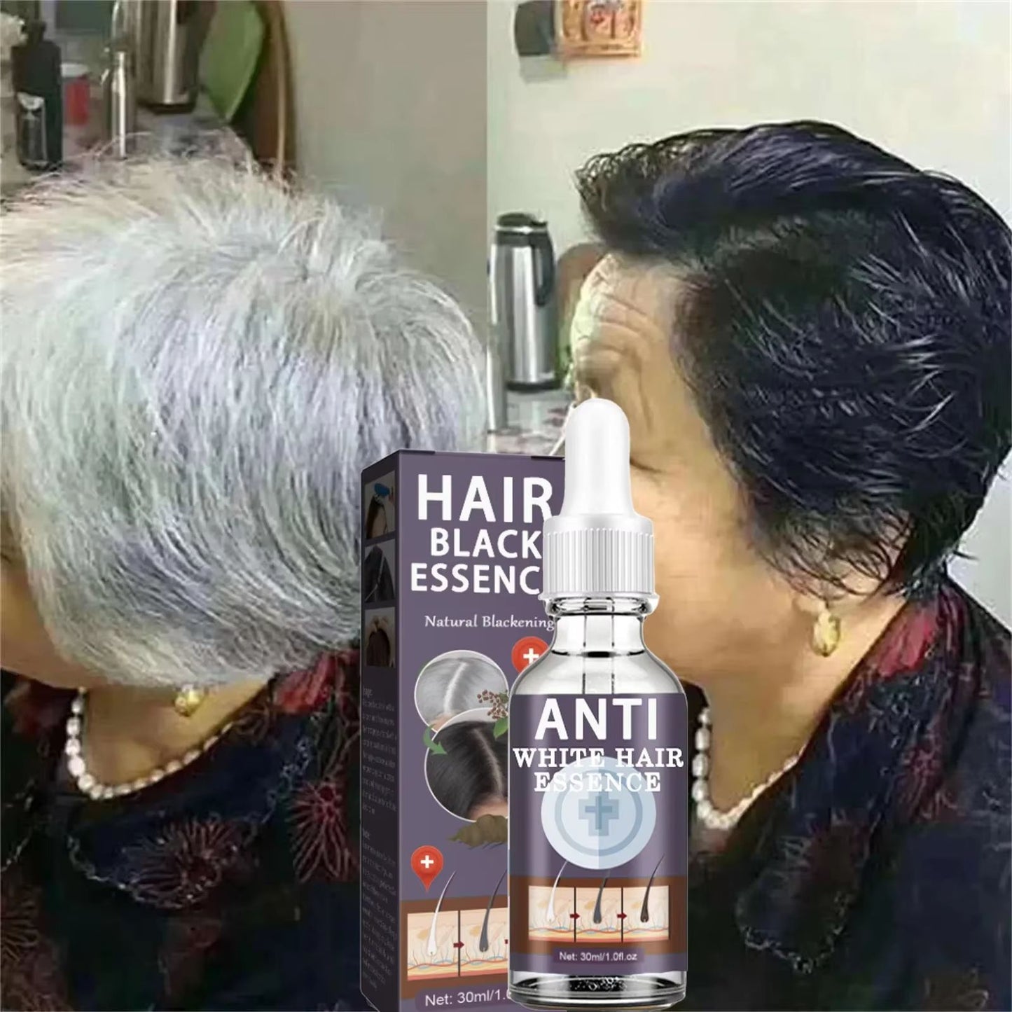 Natural Gray Hair Restoring Serum  White Hair Treatment To Revive Original Color In 7 Days 5