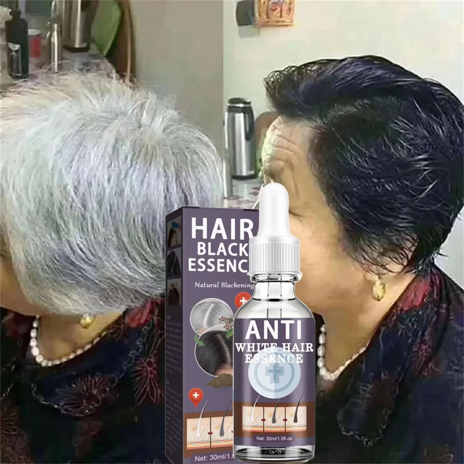 Natural Gray Hair Restoring Serum  White Hair Treatment To Revive Original Color In 7 Days 5