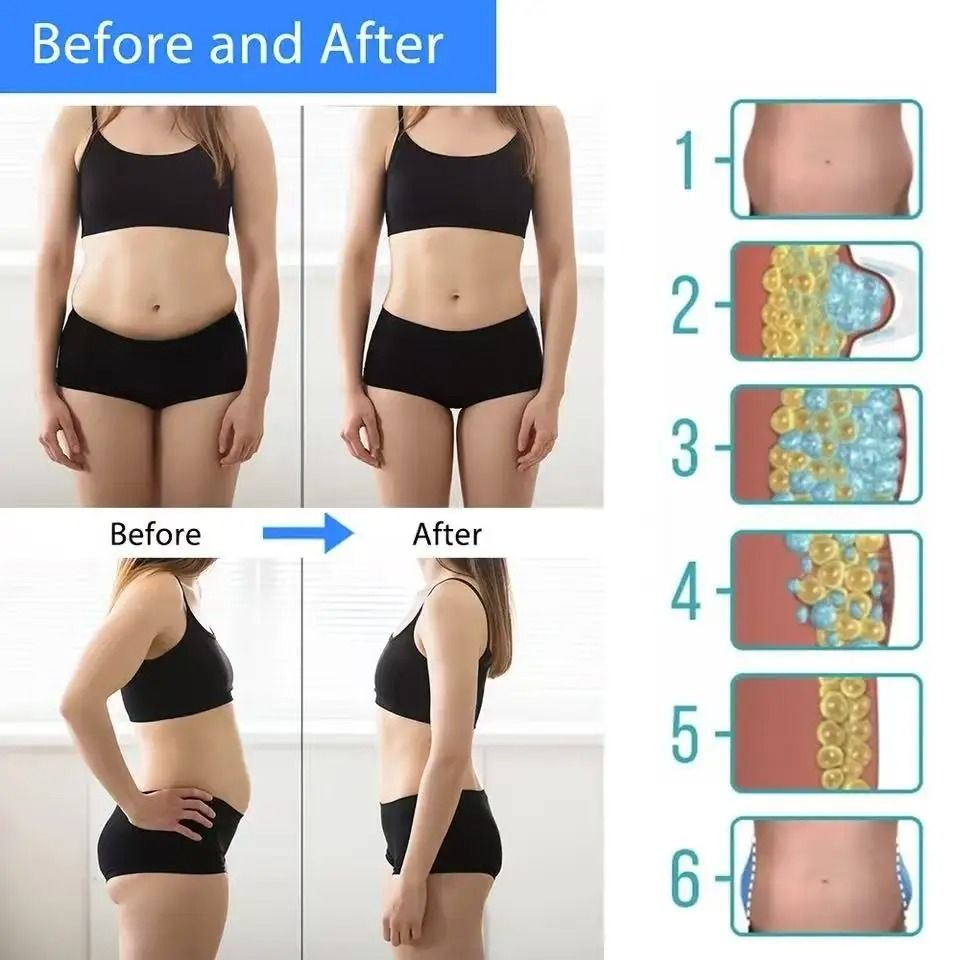 Cryotherapy Fat Dissolve Slimming Machine For Body Contouring 3