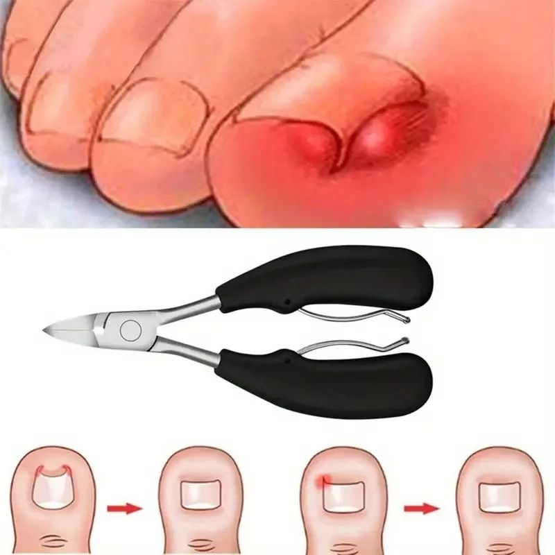 4 Piece Ingrown Toenail Clipper Set Stainless Steel For Thick Nails 2