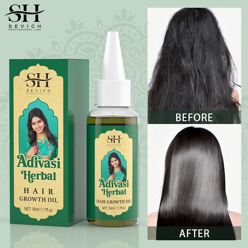Adivasi Ayurvedic Hair Growth Oil  Organic Anti Hair Loss  Fast Regrowth Serum 1