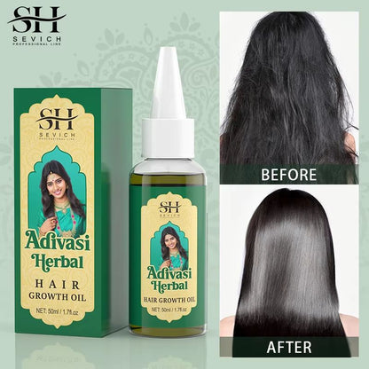 Adivasi Ayurvedic Hair Growth Oil  Organic Anti Hair Loss  Fast Regrowth Serum 1