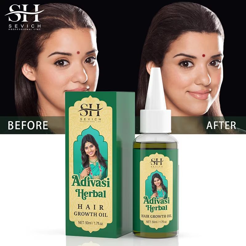 Adivasi Ayurvedic Hair Growth Oil  Organic Anti Hair Loss  Fast Regrowth Serum 4