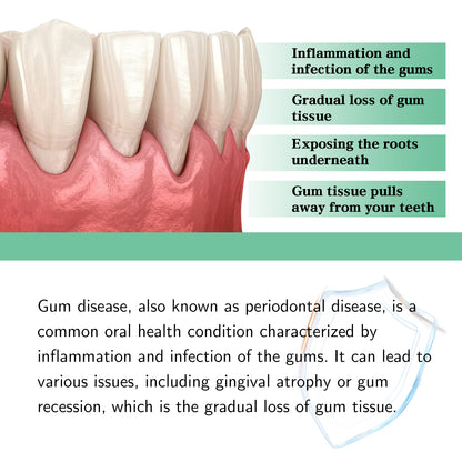 Advanced Gum Repair Serum Drops, Relieve Receding Gums, Gingival Swelling & Promote Oral Periodontal Hygiene, 30ml