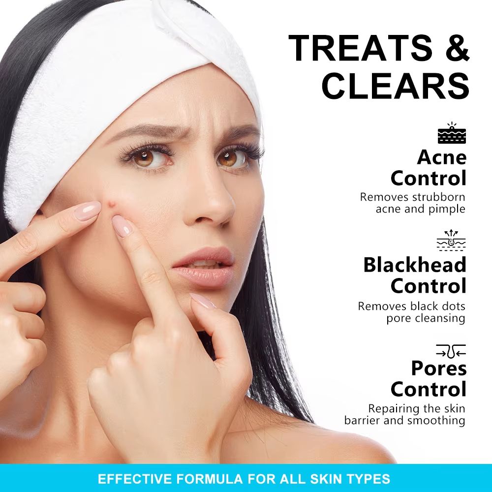 AUQUEST Salicylic Acid Acne Face Cream  Pore Refining  Blackhead Removal Niacinamide Moisturizer 1