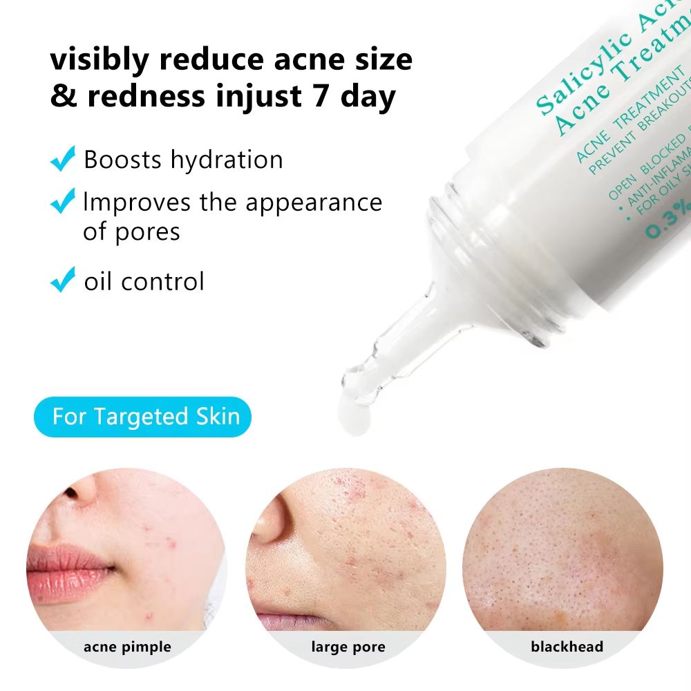 AUQUEST Salicylic Acid Acne Face Cream  Pore Refining  Blackhead Removal Niacinamide Moisturizer 2
