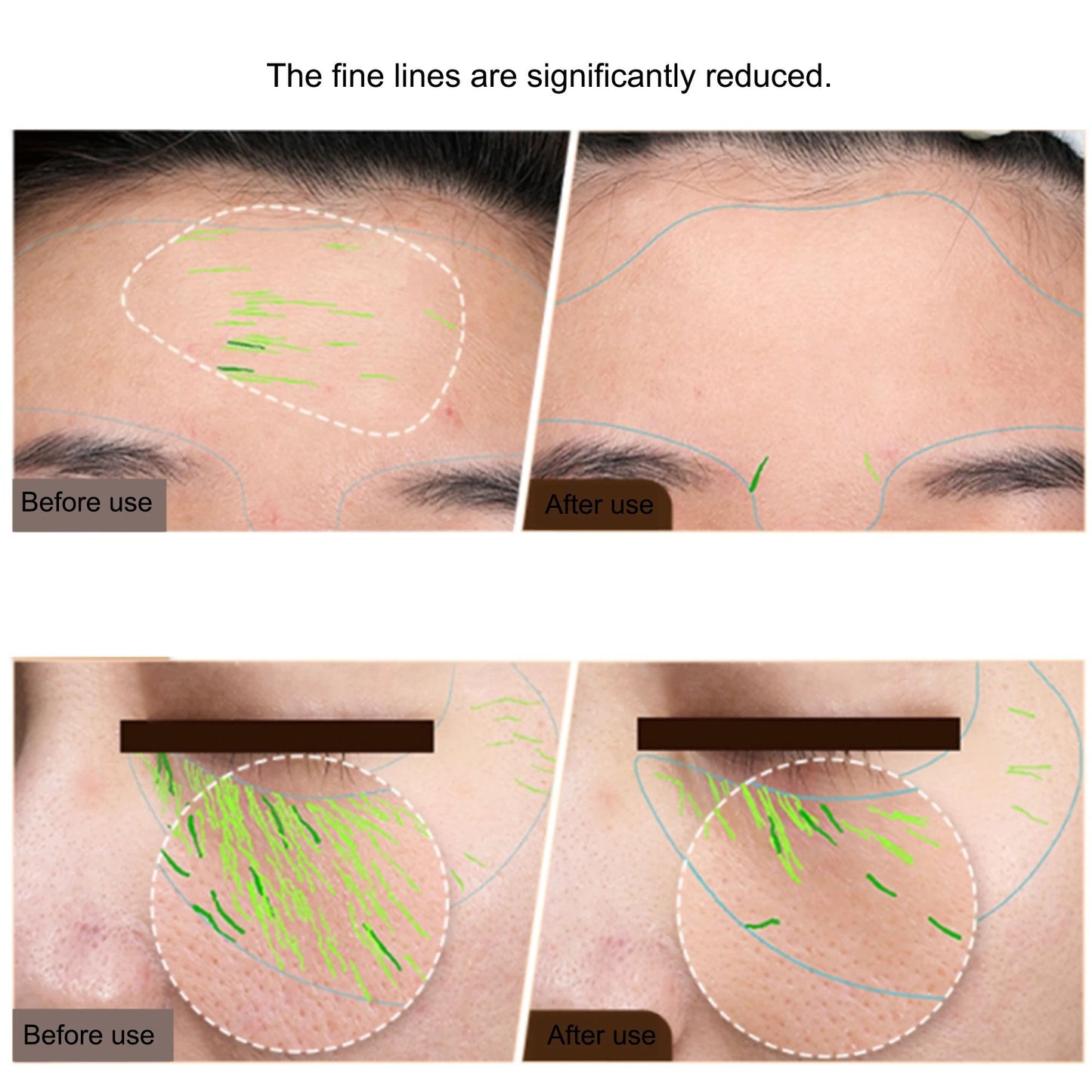 EMS RF Facial And Body Skin Tightening Device 2