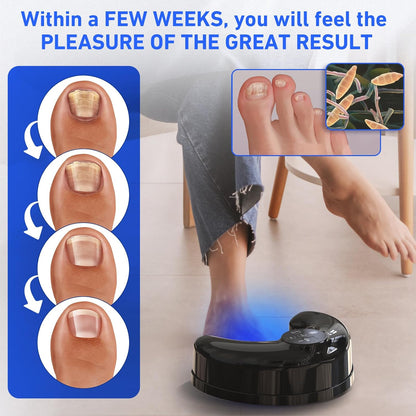 Onychomycosis Infrared Light, Wireless Nail Fungus Laser Device for Toenails, Blue Light Anti Fungal Laser Equipment
